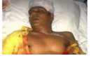 Moosa Manik in Intensive Care following a brutal assault 8.2.12